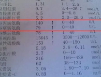 谷丙转氨酶高吃什么药,药物选择与治疗策略